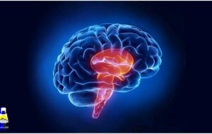 سکته مغزی چیست؟ انواع و علت آن