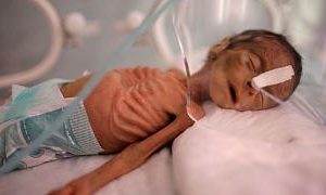 هشدار سازمان ملل نسبت به گرسنگی ۱۳ میلیون یمنی: کودکان برای غذا گدایی میکنند هشدار سازمان ملل نسبت به گرسنگی ۱۳ میلیون یمنی: کودکان برای غذا گدایی میکنند