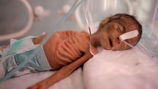 هشدار سازمان ملل نسبت به گرسنگی ۱۳ میلیون یمنی: کودکان برای غذا گدایی می‌کنند
