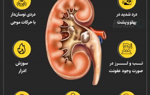 علائم سنگ کلیه