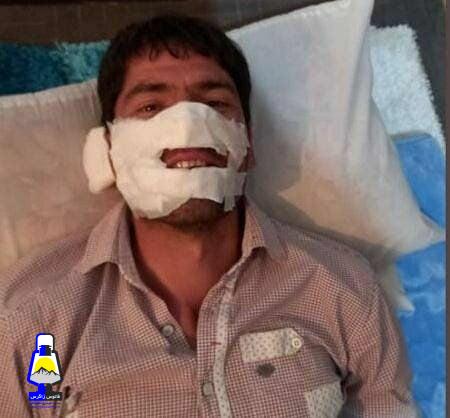 انتقال مصدوم آتش سوزی ارتفاعات باشت به شیراز
